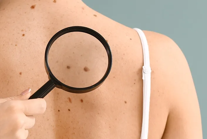 skin check berwick skin check berwick