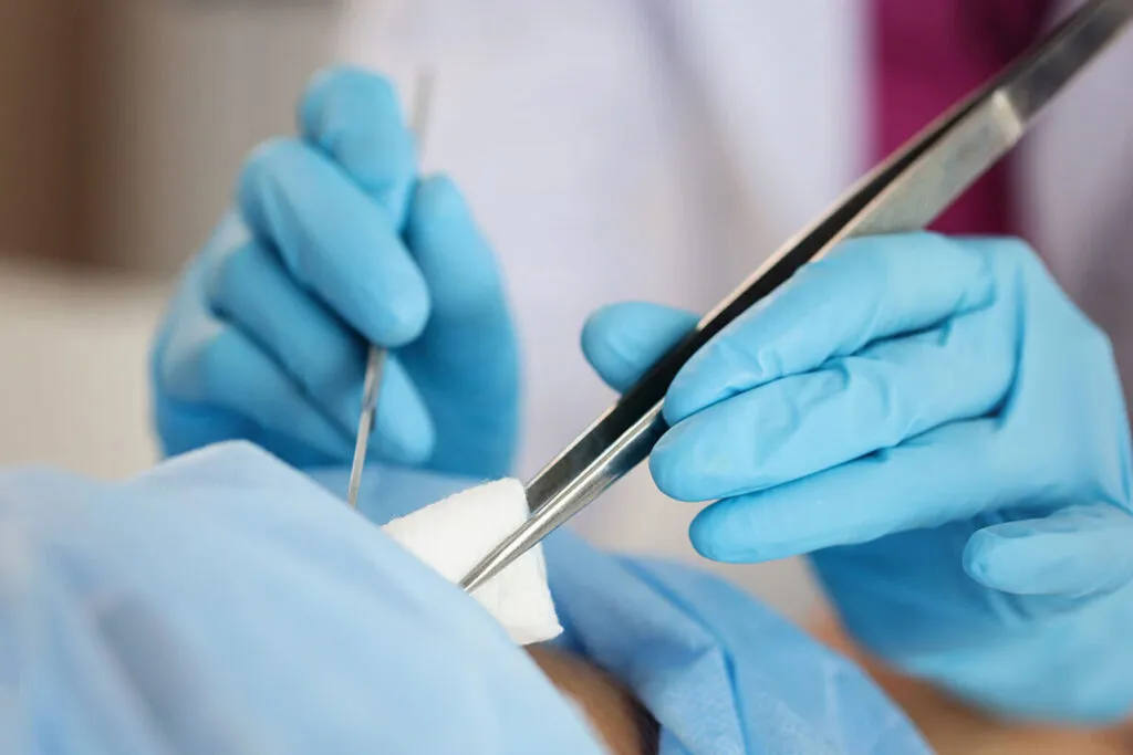 Minor Procedures Berwick Minor Procedures Berwick